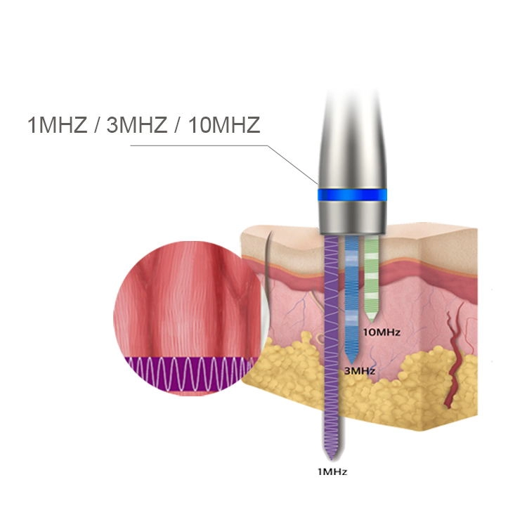 LDM Noblesse 10MHz Liệu pháp sóng siêu âm 3 trong 1 Sóng siêu âm Xóa nếp nhăn Thiết bị làm đẹp Giảm béo Dụng cụ chăm sóc da mặt