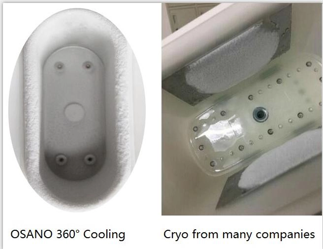 Tay cầm kép cầm tay Cryo 360 ° Máy lạnh giảm béo Giảm béo Thiết bị làm đẹp